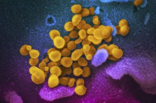 This undated electron microscope image made available by the U.S. National Institutes of Health in February 2020 shows the Novel Coronavirus SARS-CoV-2, yellow, emerging from the surface of cells, blue/pink, cultured in the lab. Also known as 2019-nCoV, the virus causes COVID-19. The sample was isolated from a patient in the U.S. (NIAID-RML via AP)