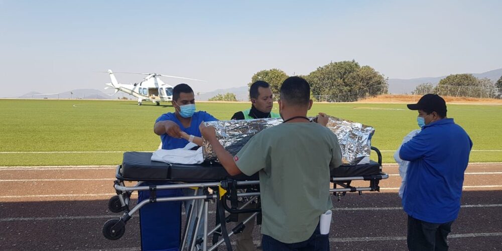 Traslada Salud Guerrero a infante por quemaduras, a la Ciudad de México